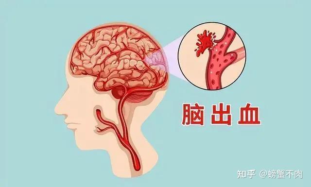 高血压的危害你注意了吗？